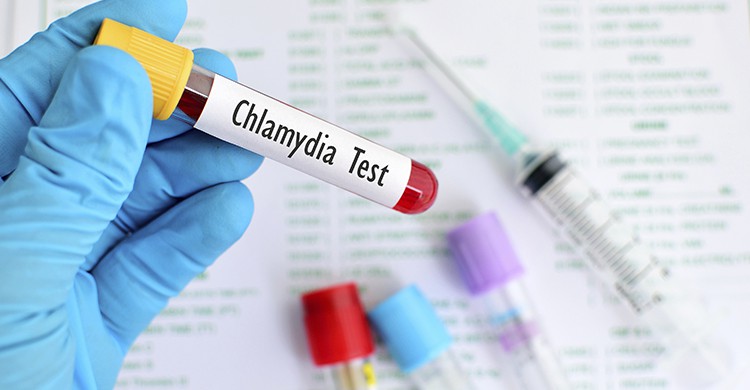 Eprouvette de laboratoire présentant des résultats d'analyse (Istock)